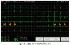 Portable pet  machine VET  machine   equipment for animals